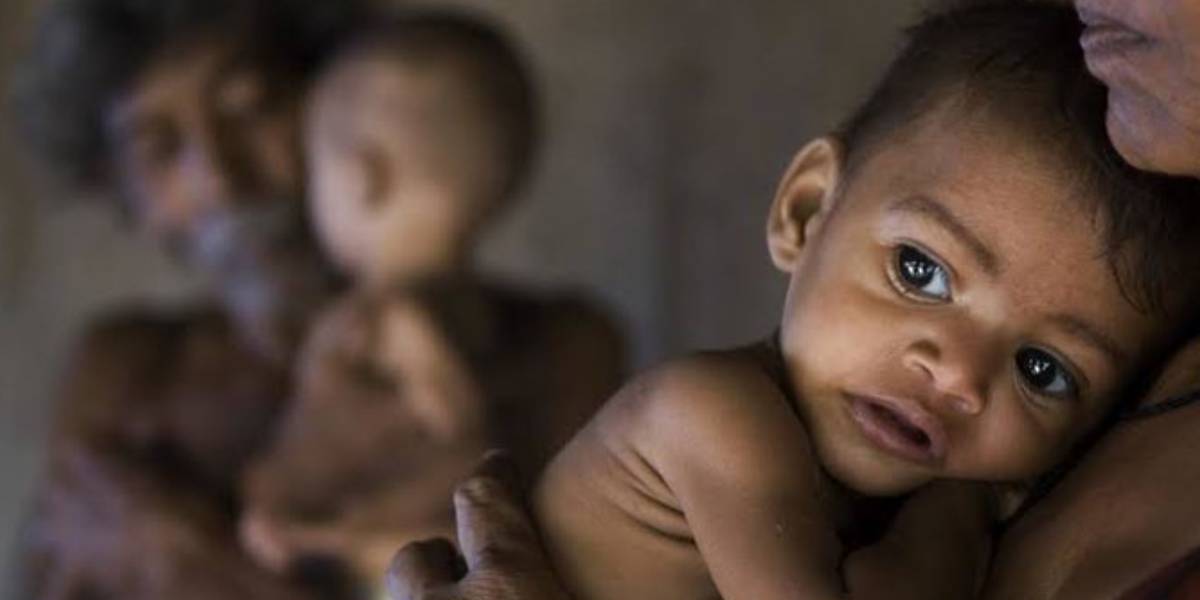 Malnutrition in India