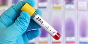 Zika virus