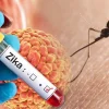 Zika virus - Pune